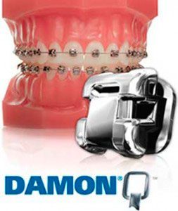 Ortodoncia Sistema Damon