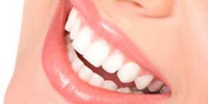 Rápido y efectivo, conseguirás aclarar hasta 4 tonos en sólo 1 hora sin dañar los dientes.