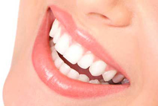 Rápido y efectivo, conseguirás aclarar hasta 4 tonos en sólo 1 hora sin dañar los dientes.